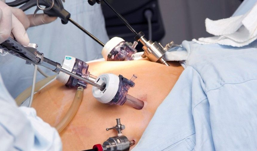 Tüp mide ameliyatında Türkiye’de başarı oranları yüksek