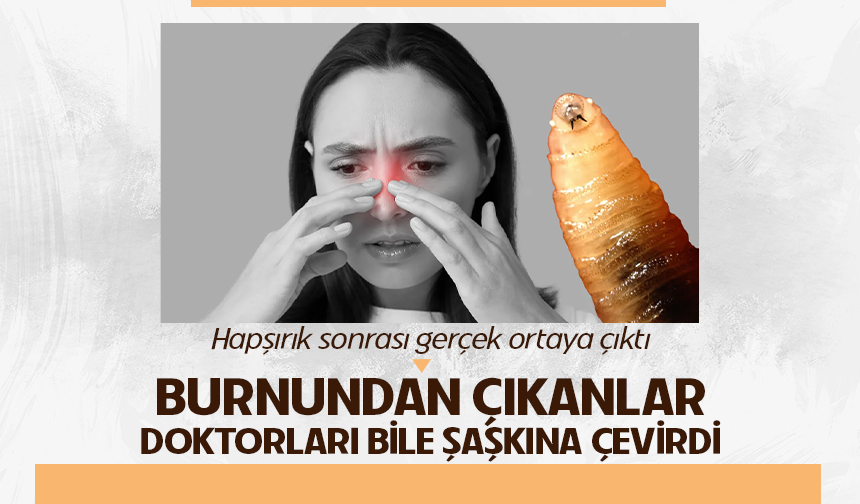 Basit bir grip sandı, gerçek hapşırınca ortaya çıktı! Burnundan çıkanlar doktorları bile şaşkına çevirdi