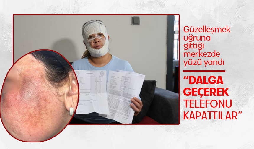 Güzelleşmek uğruna gittiği merkezde yüzü yandı