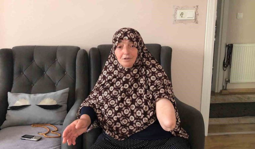 Köpekler kolunu parçaladı, gözleri açık gitti