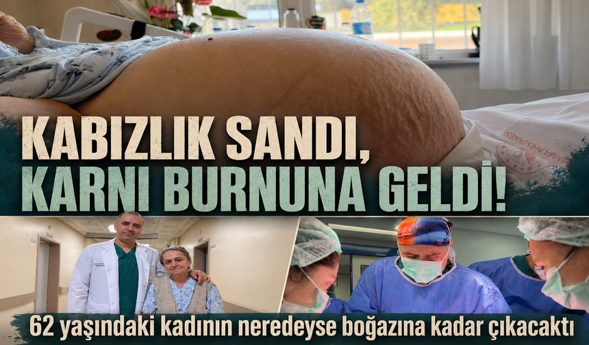 Karnındaki devasa şişlik 22 kiloluk tümör çıktı: "Kabızlık diye düşündüm" dedi
