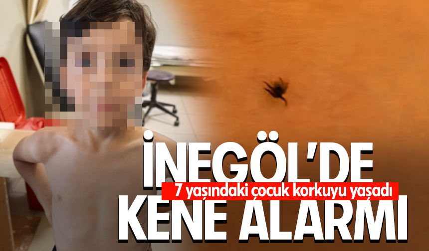 Bursa İnegöl'de Kene alarmı: 7 yaşındaki çocuk korkuyu yaşadı