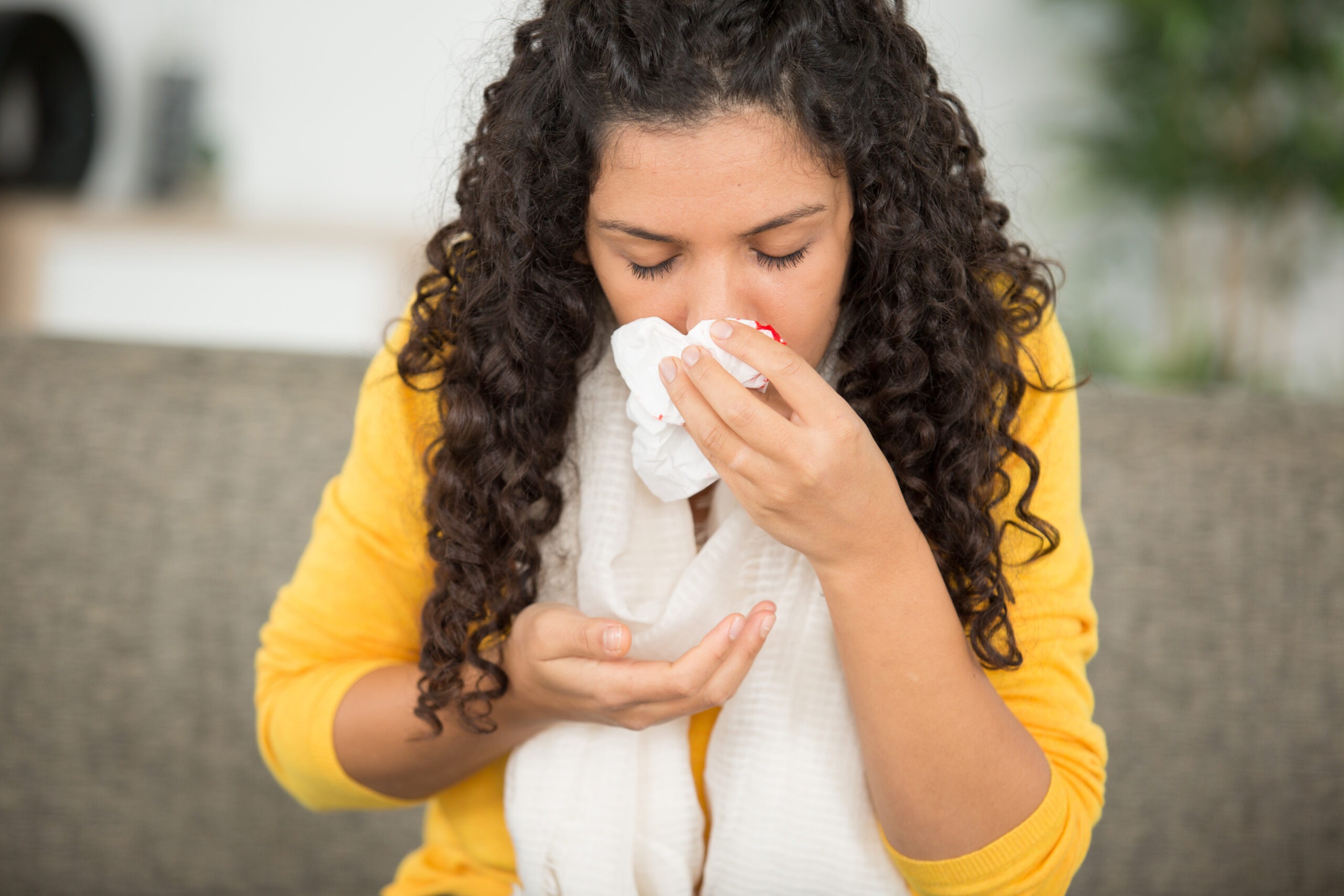 Home Remedies For Nose Bleeds Scaled