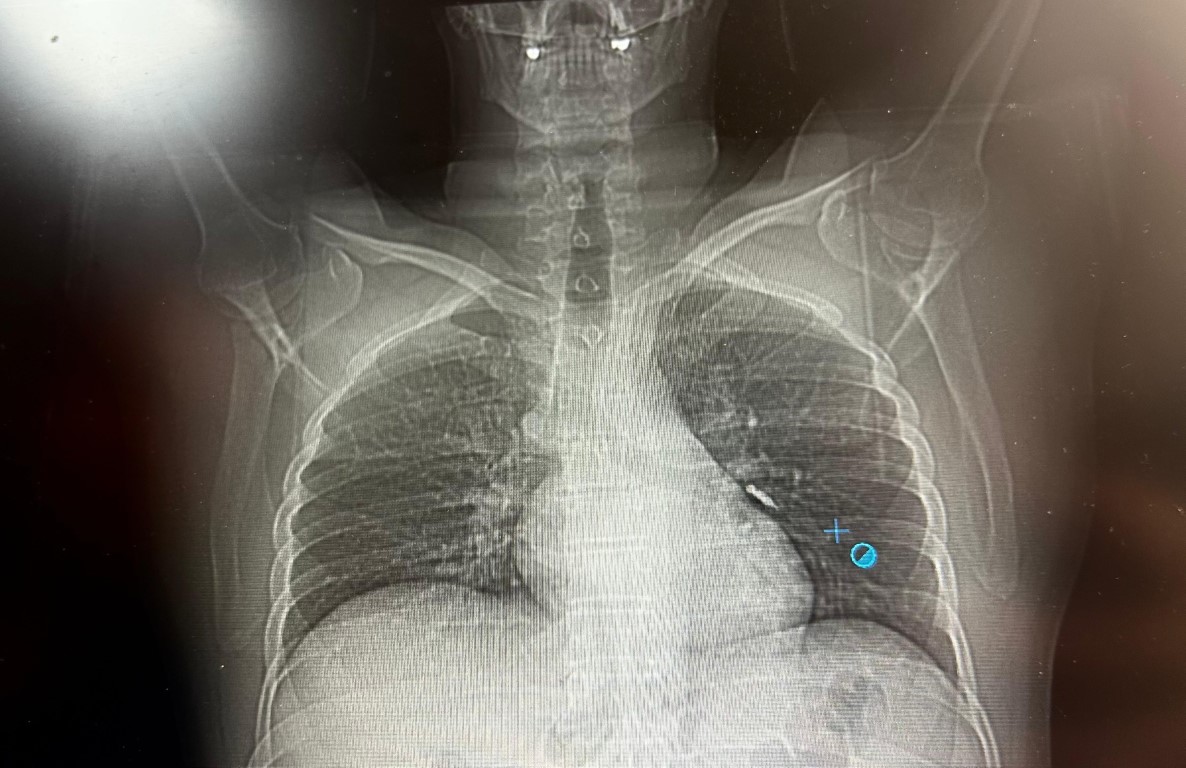 Aw504329 01